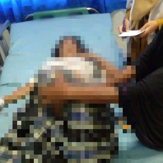 Wanita Muda Asal Limapuluh Kota Meninggal Akibat Dugaan Penganiayaan