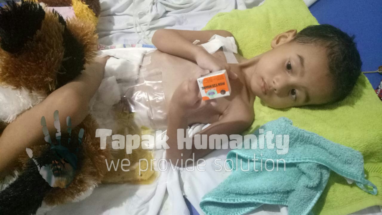 Wabup Limapuluh Kota Terenyuh Melihat Bocah Usia 3 Tahun ini