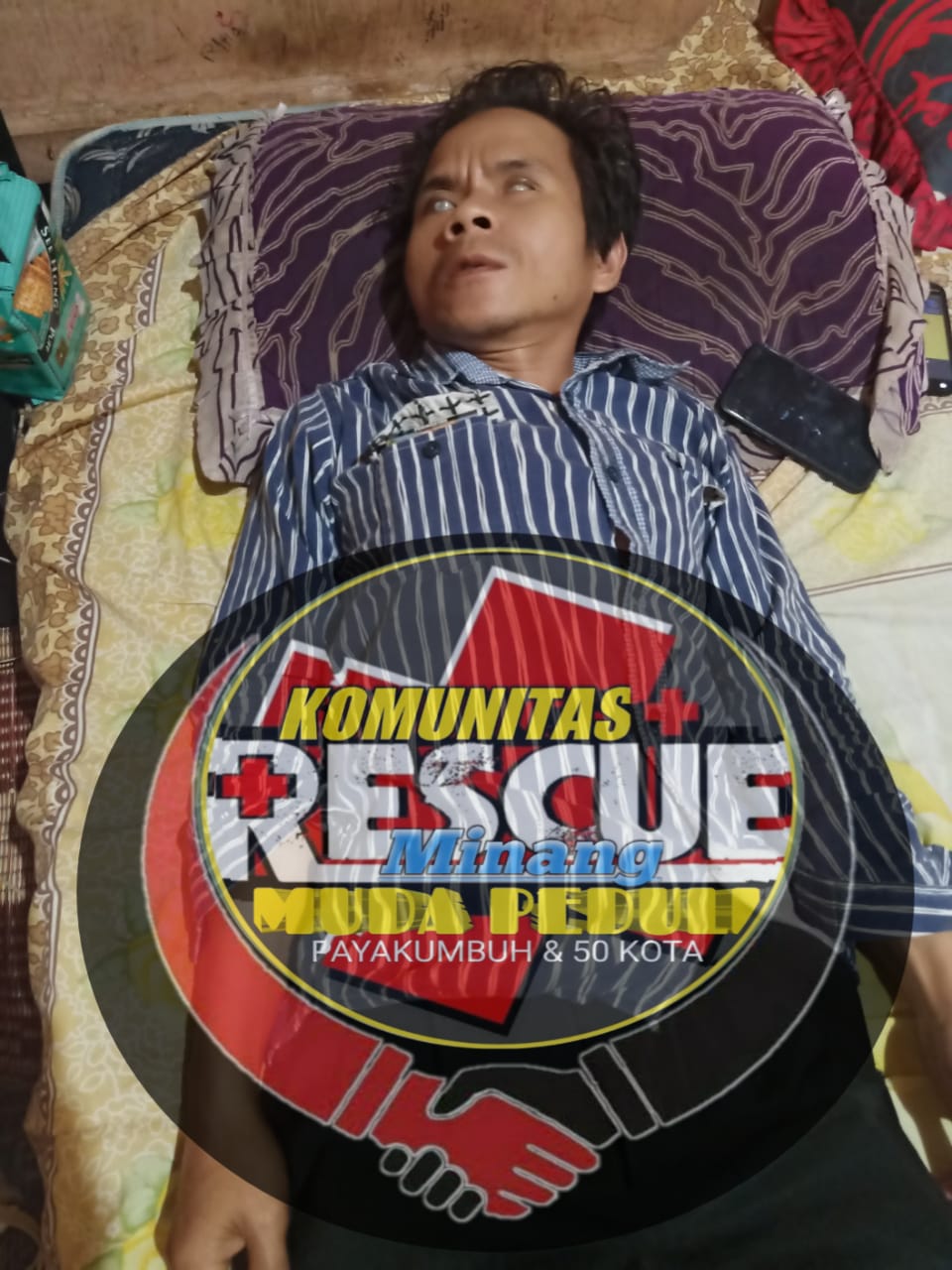 Butuh Uluran Tangan, Seorang Penyandang Disabilitas di Payakumbuh Terbaring Lemah Menahan Sakit Usai Kecelakaan