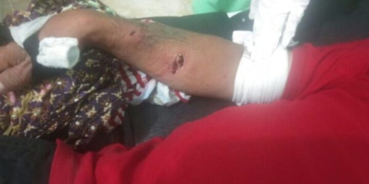 Seorang Pria (45) Nyaris Tewas Diterkam Buaya di Batang Masang Kinali