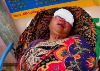 Solok Berduka Perampok Aniaya Ibu Rumah Tangga Hingga Dilarikan ke Rumah Sakit