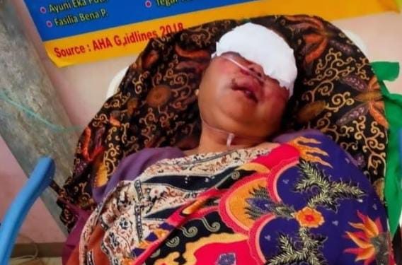 Solok Berduka Perampok Aniaya Ibu Rumah Tangga Hingga Dilarikan ke Rumah Sakit