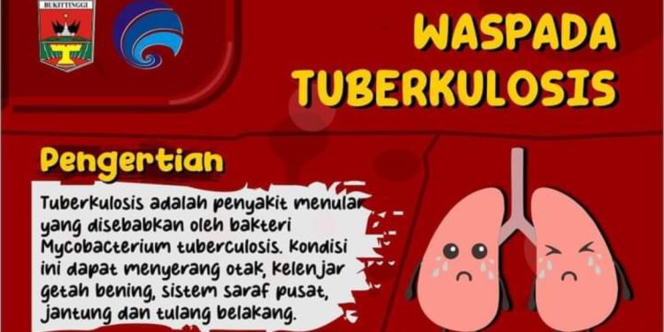 Waspada Tuberkulosis, Walikota Bukittinggi: Dapatkan Pelayanan Terbaik Kota Ini