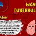 Waspada Tuberkulosis, Walikota Bukittinggi: Dapatkan Pelayanan Terbaik Kota Ini
