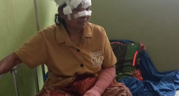 Pemkot Padang Luncurkan 10 Armada Baru Trans Padang untuk Layani Koridor 3 dan 2