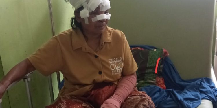 Bantu Warga Solok yang Diterkam Beruang dengan Cara Transfer ke Rekening Ini