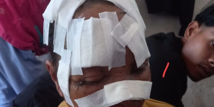Warga Solok yang Diserang Beruang Meninggal Dunia