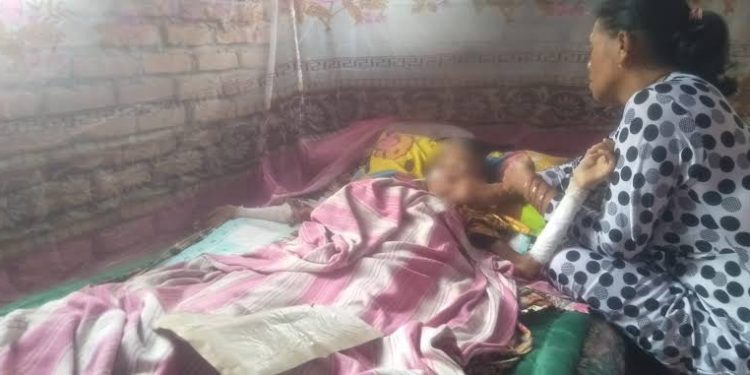 Aldelia, Korban ‘Pembakaran’ di Padang Pariaman, Kini Mendapat Perawatan Gratis setelah Kunjungan Langsung dari Bupati