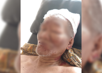 Seorang Kakek Alami Kekerasan Brutal di Agam, Kuasa Hukum Minta Kepolisian Tindak Tegas Terduga